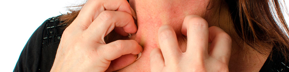 O que é choque anafilático, sintomas e como tratar O que é choque anafilático, sintomas e como tratar