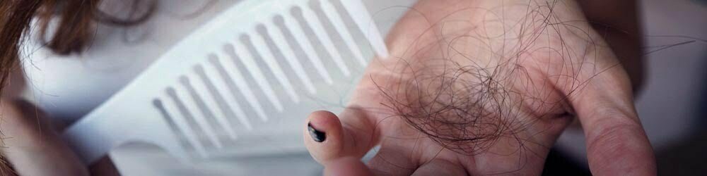 Quando a queda de cabelo é um problema?